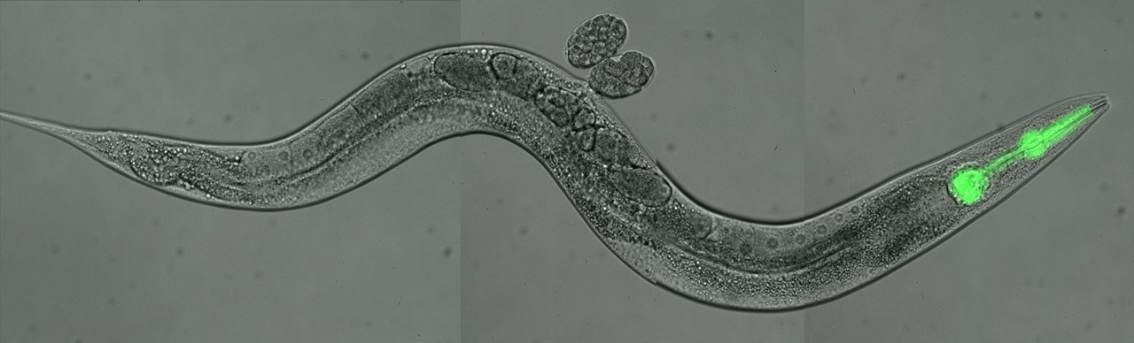 Magnified view of a C. elegans worm with a green fluorescent pharynx.